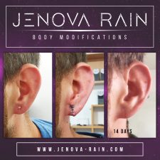 Ear Lobe Reconstruction by Jenova Rain in Leicester