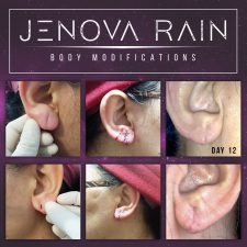 Ear Lobe Reconstruction by Jenova Rain UK