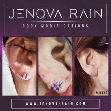 Ear Lobe Repair by Jenova Rain UK