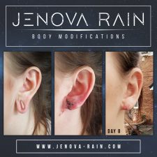 Ear Lobe Repair by Jenova Rain UK