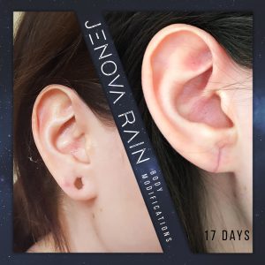 Ear Lobe Repair UK by Jenova Rain