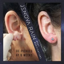 Stretched Ear Lobe Repair UK by Jenova Rain