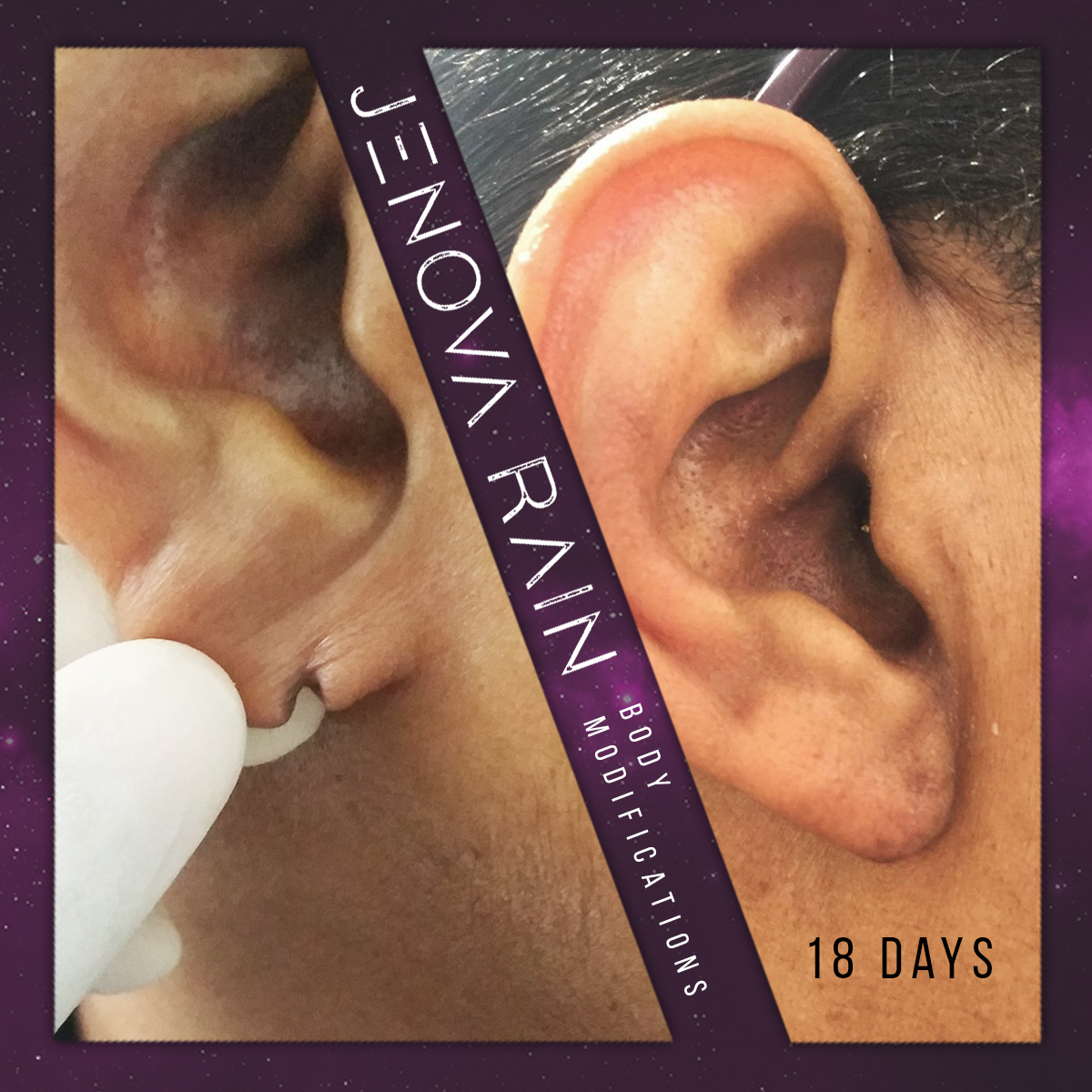 Split Ear Lobe Repair UK by Jenova Rain
