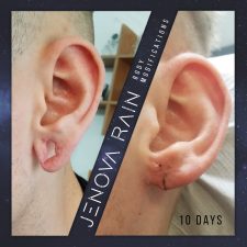 Stitched Ear Lobe Repair UK by Jenova Rain