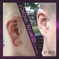 Ear Lobe Hole Reconstruction UK by Jenova Rain