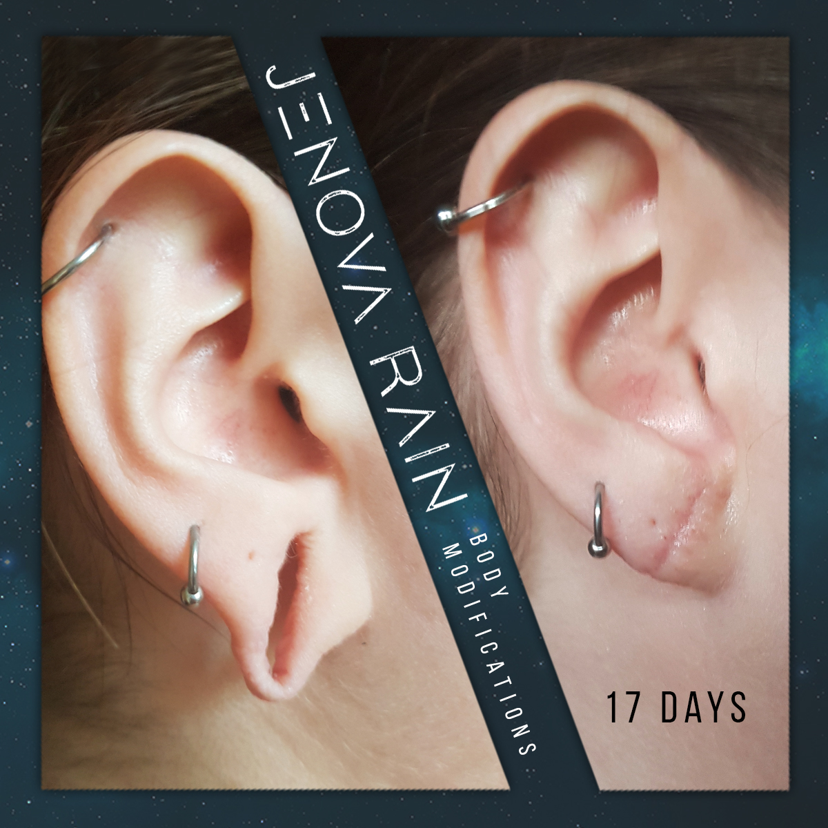 Stretched Ear Lobe Hole Repair UK by Jenova Rain