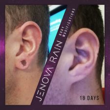 Damaged Ear Lobe Repair UK by Jenova Rain