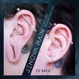 ear lobe reconstruction uk jenova rain