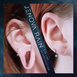 Stretched Ear Lobe Repair UK by Jenova Rain